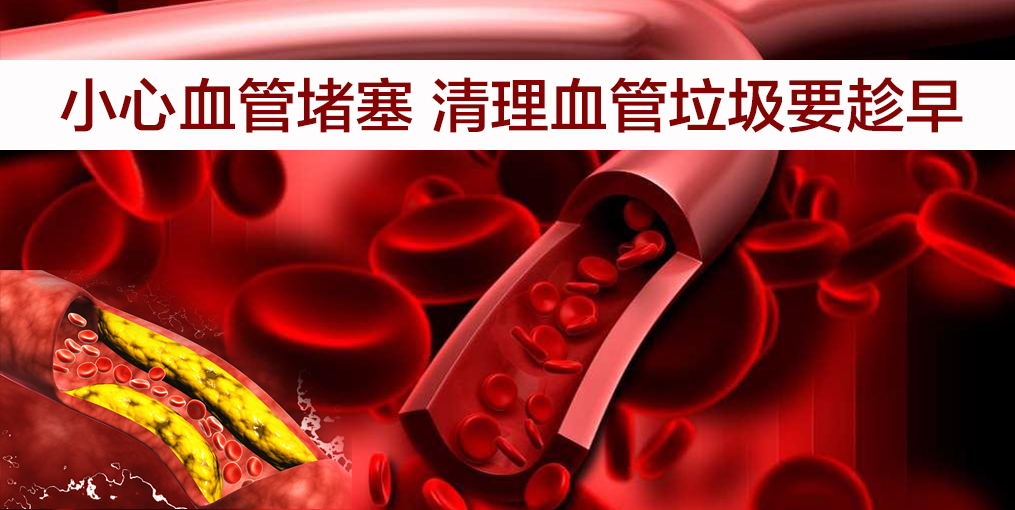 當(dāng)心！這幾類人群血管最易堵，適當(dāng)補(bǔ)硒遠(yuǎn)離血管疾病