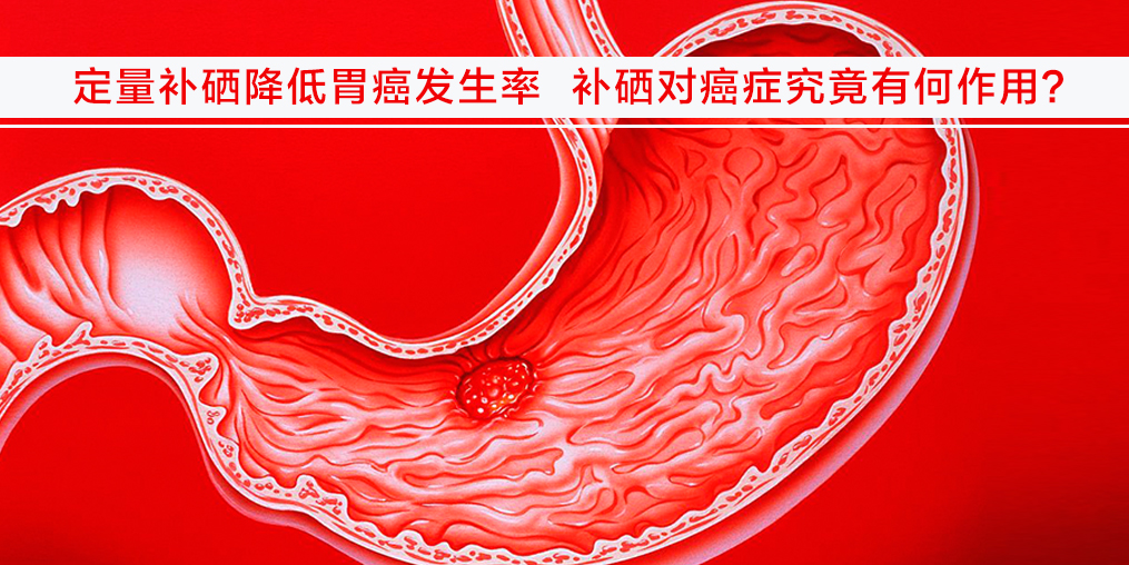 遠(yuǎn)離胃癌不難，改變不良習(xí)慣外多補(bǔ)硒