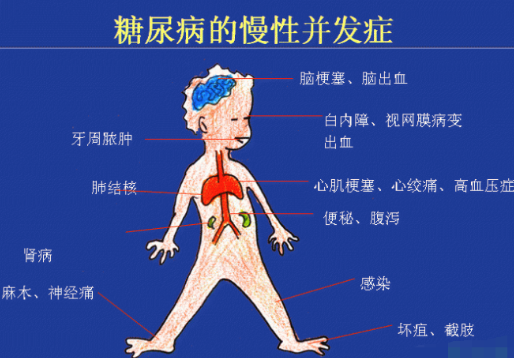 你還在害怕糖尿病嗎？科學(xué)補硒不“恐糖”