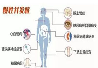 遠(yuǎn)離高血糖并發(fā)癥，請記住一點，學(xué)會“補硒”