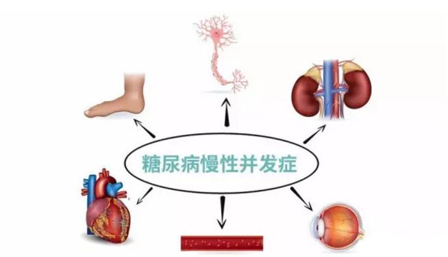 血糖波動(dòng)大，并發(fā)癥來(lái)得快，糖友要多補(bǔ)硒